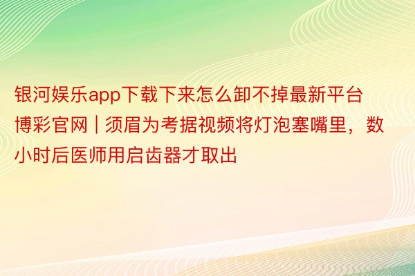 银河娱乐app下载下来怎么卸不掉最新平台博彩官网 | 须眉为考据视频将灯泡塞嘴里，数小时后医师用启齿器才取出